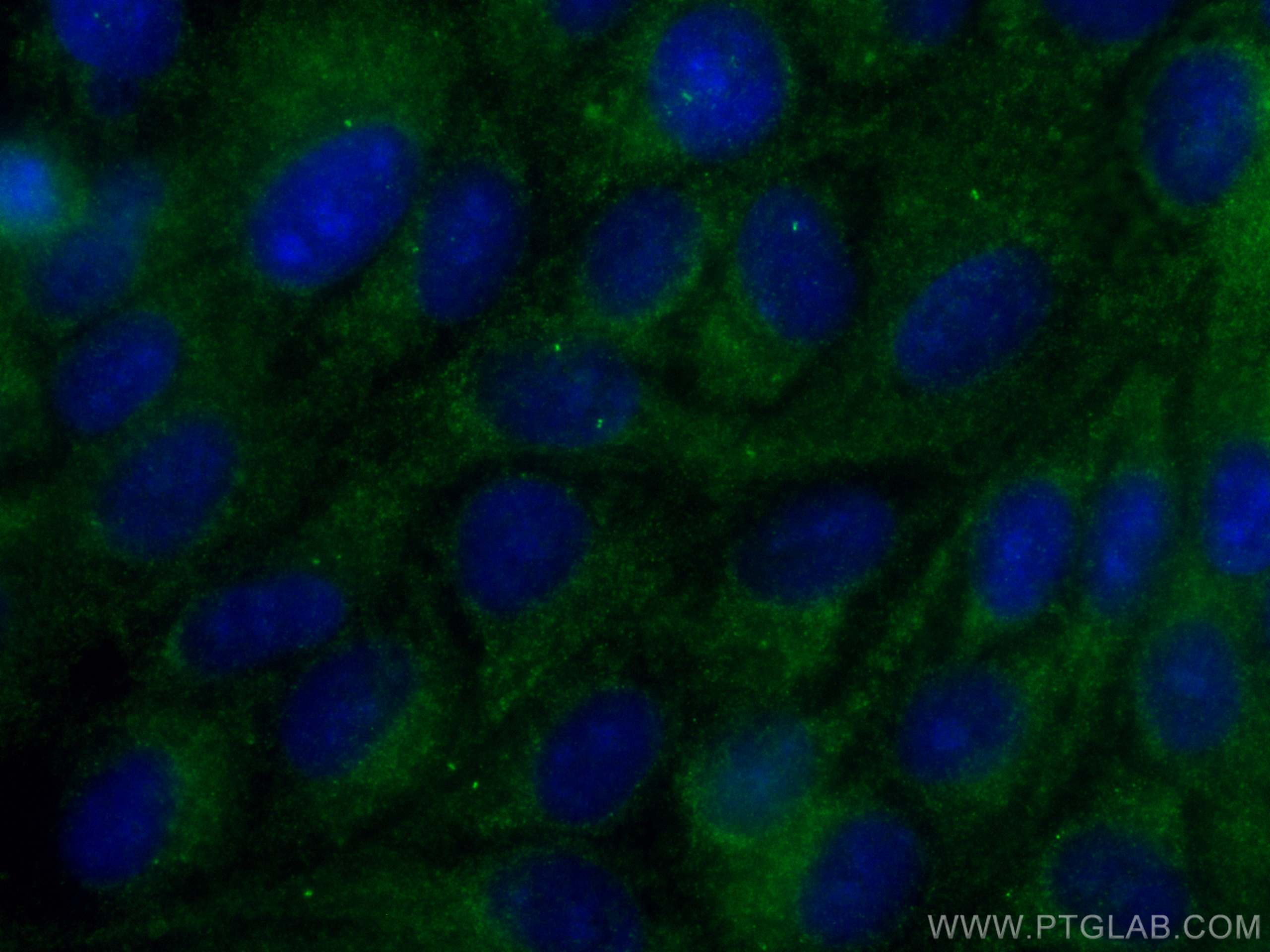 Immunofluorescence (IF) / fluorescent staining of hTERT-RPE1 cells using CoraLite® Plus 488-conjugated CEP63 Monoclonal ant (CL488-66996)