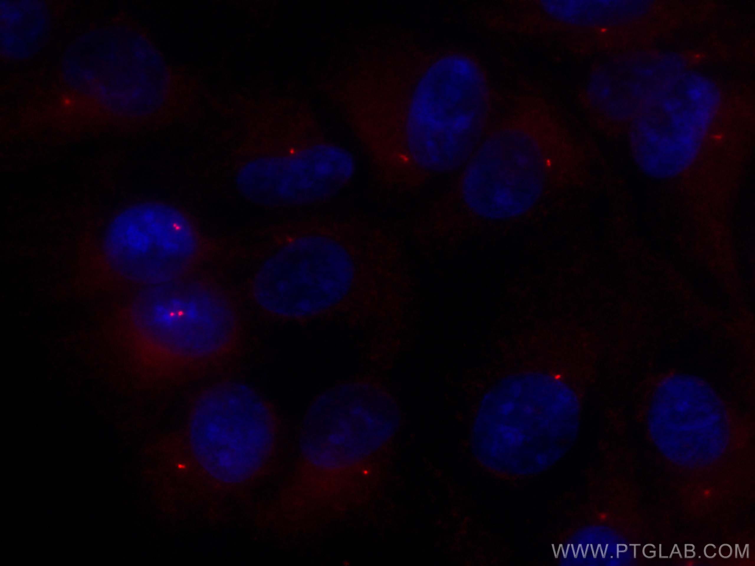 Immunofluorescence (IF) / fluorescent staining of hTERT-RPE1 cells using CoraLite®594-conjugated CEP63 Polyclonal antibody (CL594-16268)