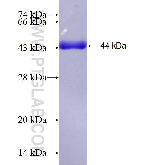 CEP63 fusion protein Ag9227 SDS-PAGE