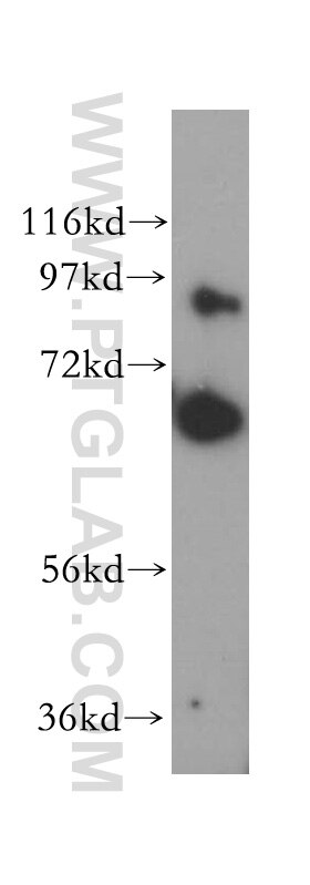 Western Blot (WB) analysis of HeLa cells using CEP68 Polyclonal antibody (15147-1-AP)