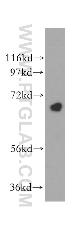 Western Blot (WB) analysis of Jurkat cells using CEP68 Polyclonal antibody (15147-1-AP)