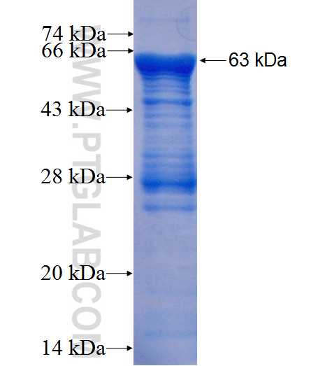 CEP68 fusion protein Ag7447 SDS-PAGE