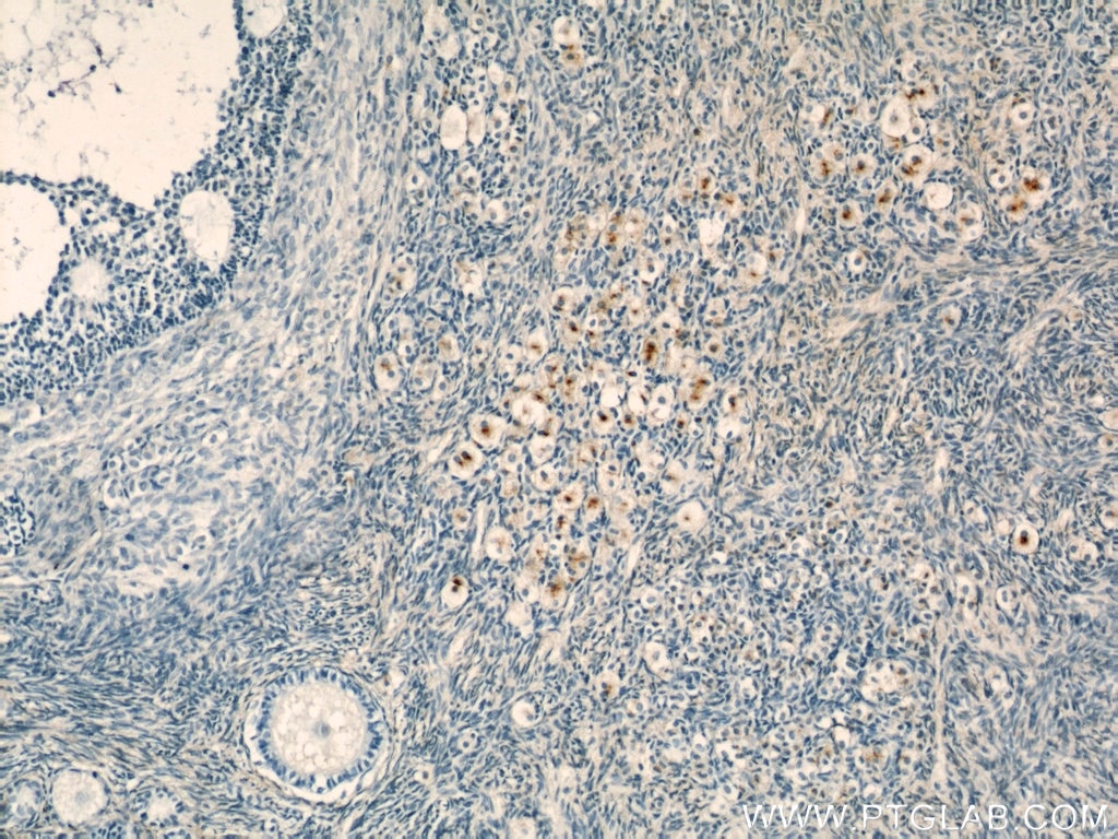 Immunohistochemistry (IHC) staining of human ovary tissue using CEP70 Polyclonal antibody (16280-1-AP)
