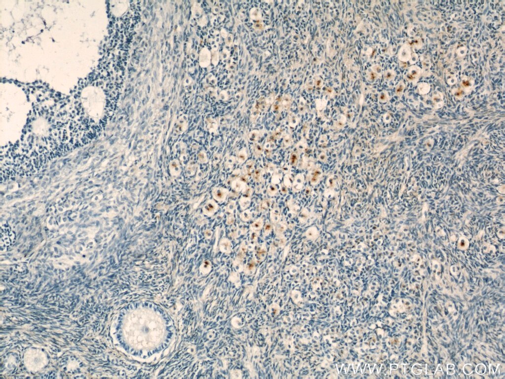 IHC staining of human ovary using 16280-1-AP