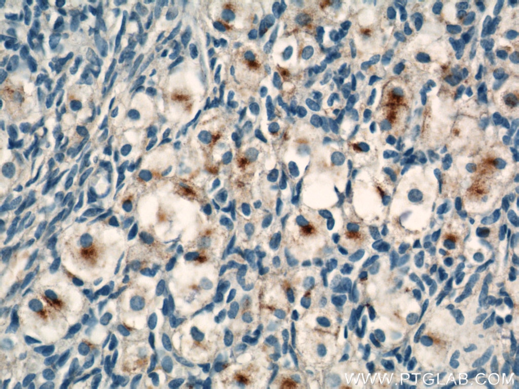 Immunohistochemistry (IHC) staining of human ovary tissue using CEP70 Polyclonal antibody (16280-1-AP)