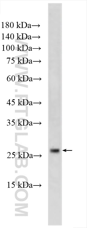 Western Blot (WB) analysis of human placenta tissue using CEP70 Polyclonal antibody (16280-1-AP)