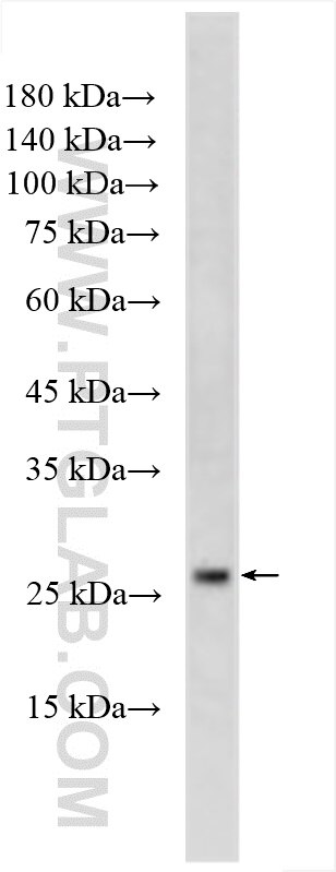 WB analysis of human placenta using 16280-1-AP