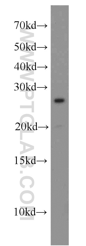 Western Blot (WB) analysis of mouse testis tissue using CEP70 Polyclonal antibody (16280-1-AP)
