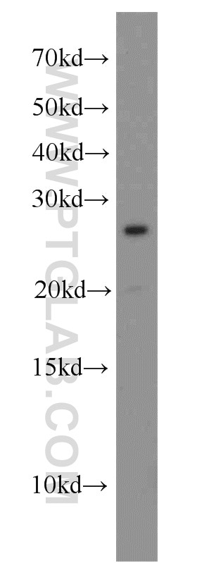 WB analysis of mouse testis using 16280-1-AP