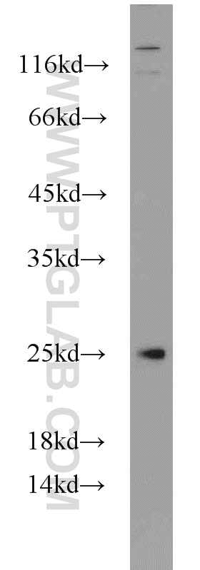 Western Blot (WB) analysis of PC-3 cells using CEP70 Polyclonal antibody (16280-1-AP)