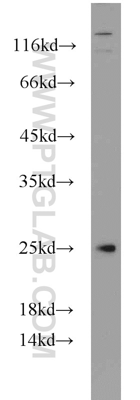 WB analysis of PC-3 using 16280-1-AP