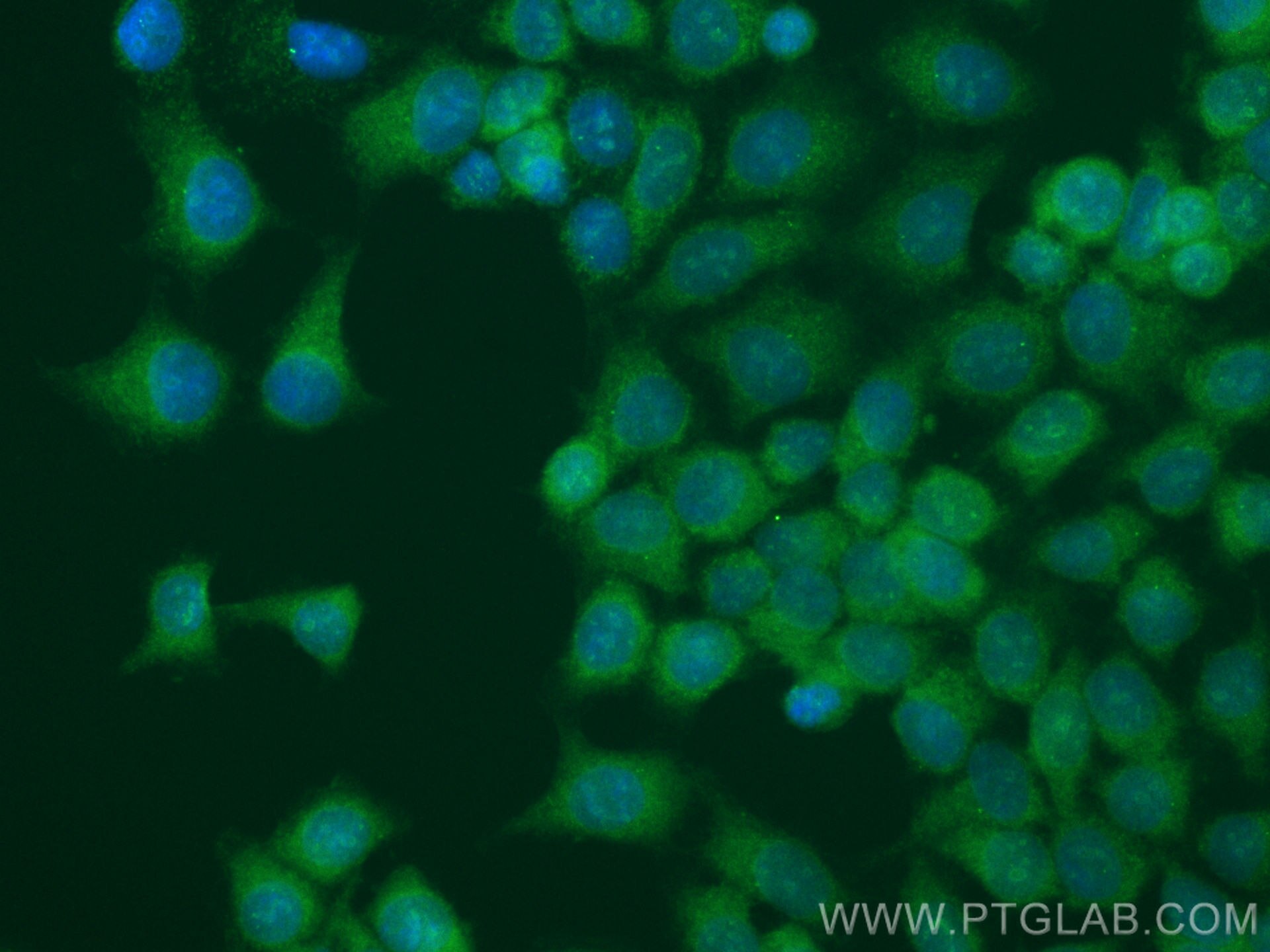 Immunofluorescence (IF) / fluorescent staining of MCF-7 cells using CoraLite® Plus 488-conjugated CEP70 Polyclonal ant (CL488-16280)