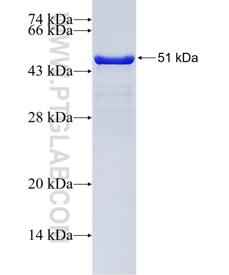 CEP70 fusion protein Ag9365 SDS-PAGE