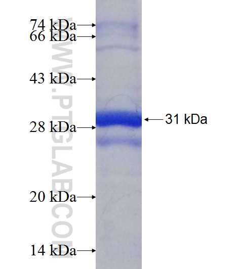 CEP70 fusion protein Ag9515 SDS-PAGE