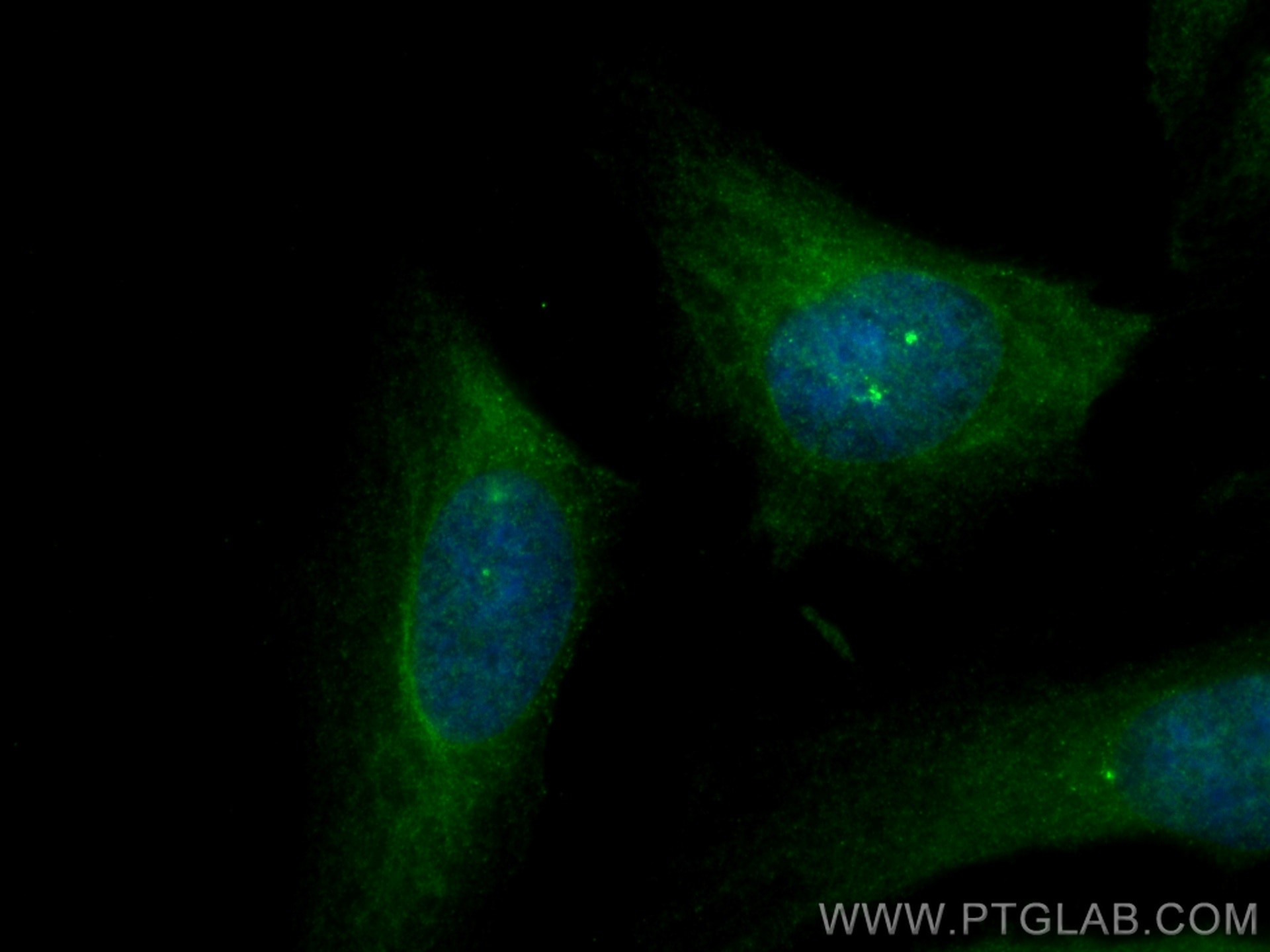 Immunofluorescence (IF) / fluorescent staining of HeLa cells using CEP72 Polyclonal antibody (19928-1-AP)