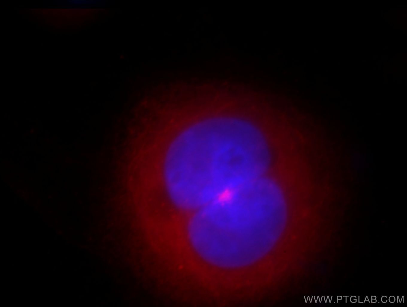 Immunofluorescence (IF) / fluorescent staining of HeLa cells using CEP72 Polyclonal antibody (19928-1-AP)