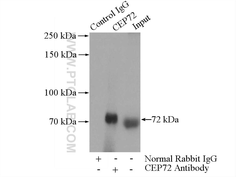 Immunoprecipitation (IP) experiment of HeLa cells using CEP72 Polyclonal antibody (19928-1-AP)