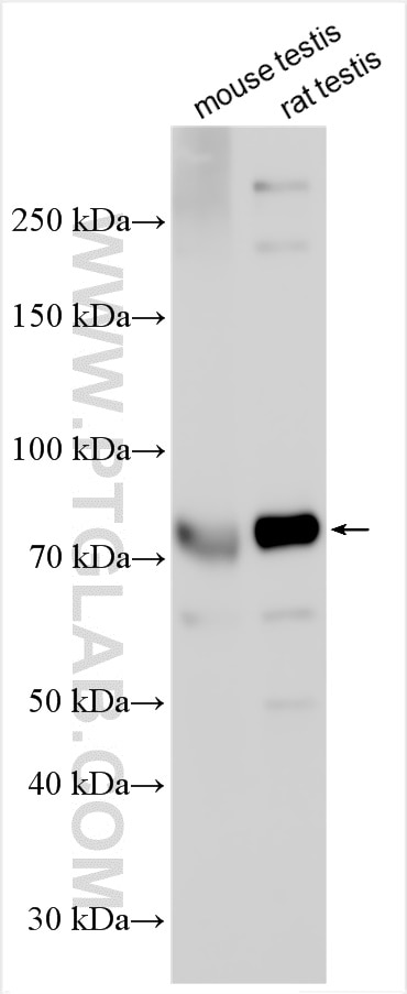 Western Blot (WB) analysis of various lysates using CEP72 Polyclonal antibody (19928-1-AP)