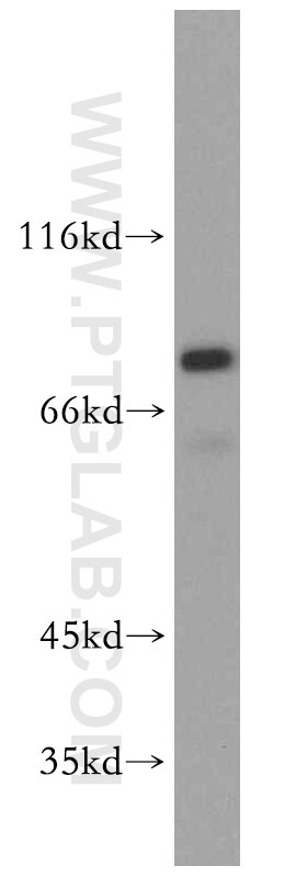 Western Blot (WB) analysis of mouse testis tissue using CEP72 Polyclonal antibody (19928-1-AP)