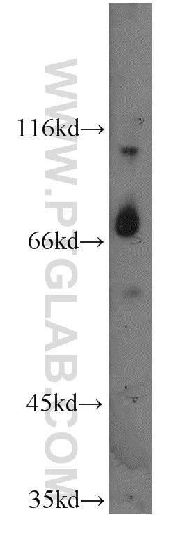 Western Blot (WB) analysis of HEK-293 cells using CEP72 Polyclonal antibody (19928-1-AP)