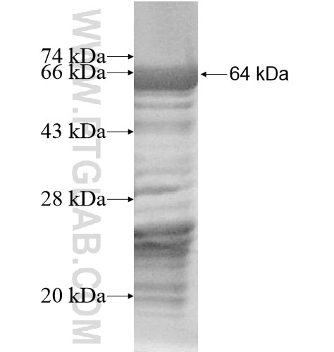 CEP72 fusion protein Ag13905 SDS-PAGE