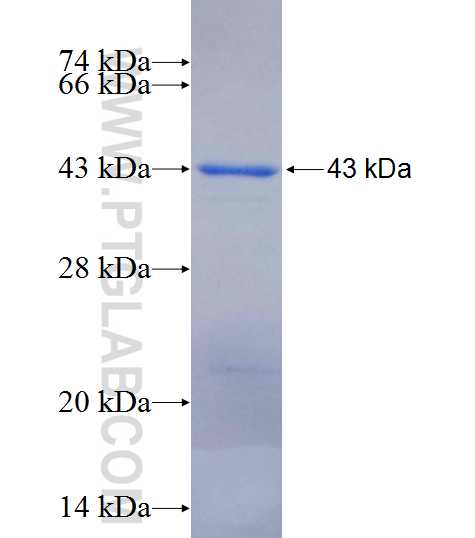 CEP72 fusion protein Ag13954 SDS-PAGE