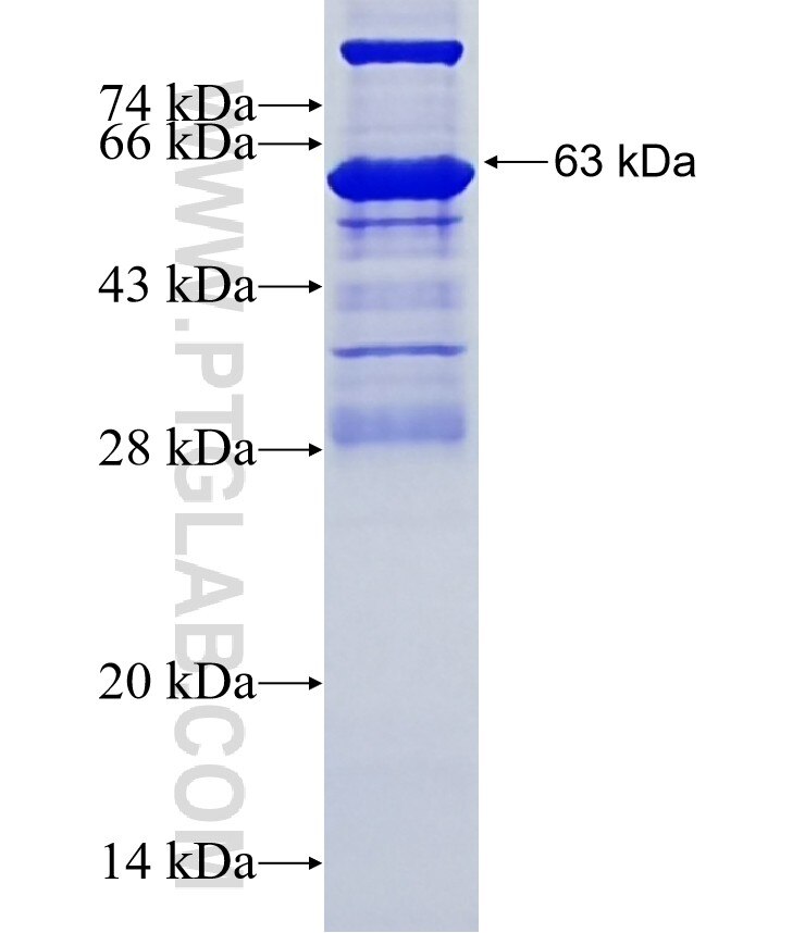 CEP76 fusion protein Ag10572 SDS-PAGE