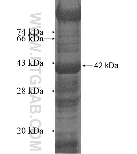 CEP76 fusion protein Ag10835 SDS-PAGE