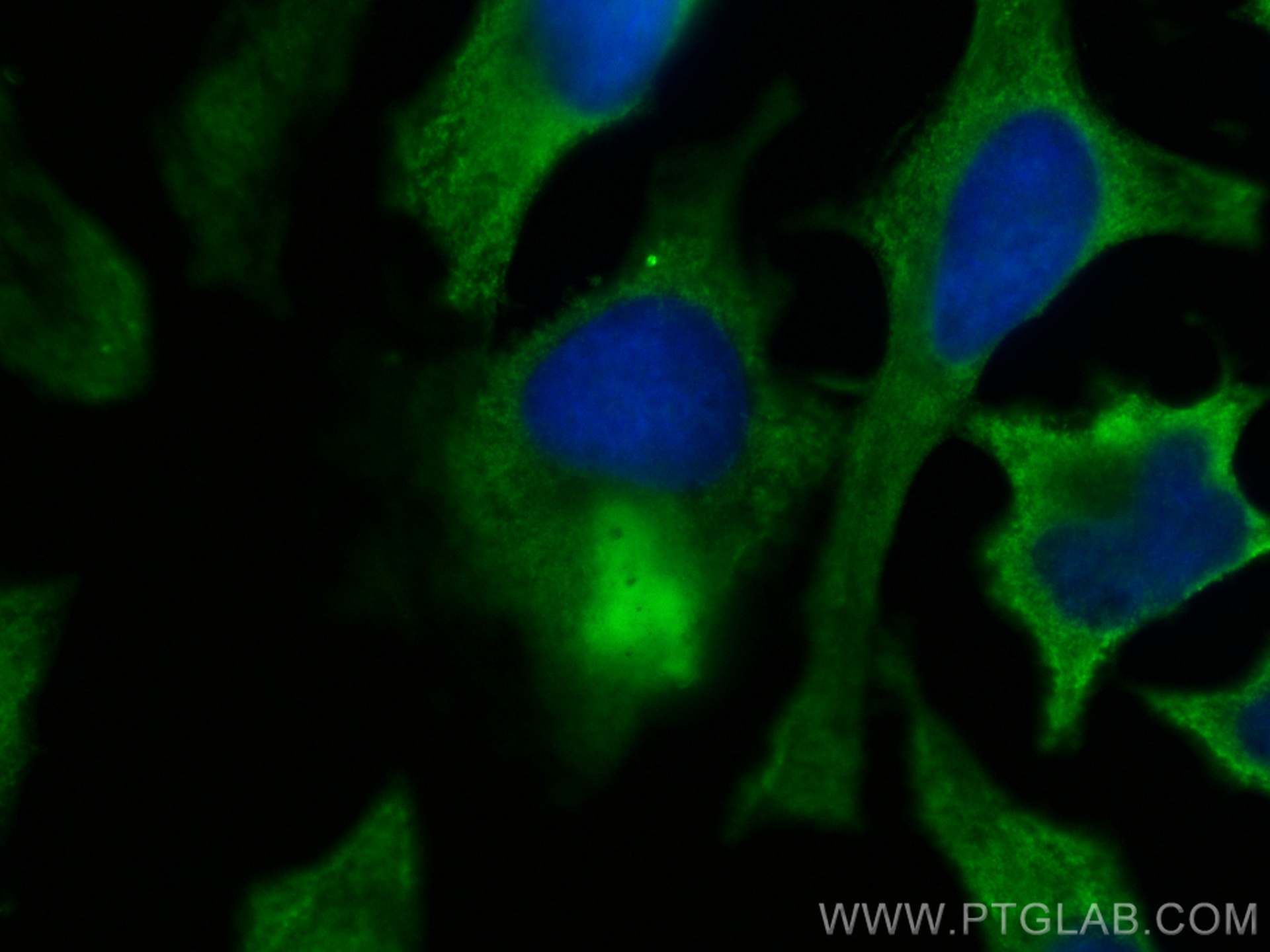 Immunofluorescence (IF) / fluorescent staining of HeLa cells using CoraLite® Plus 488-conjugated CEP89, CCDC123 Monoc (CL488-68112)