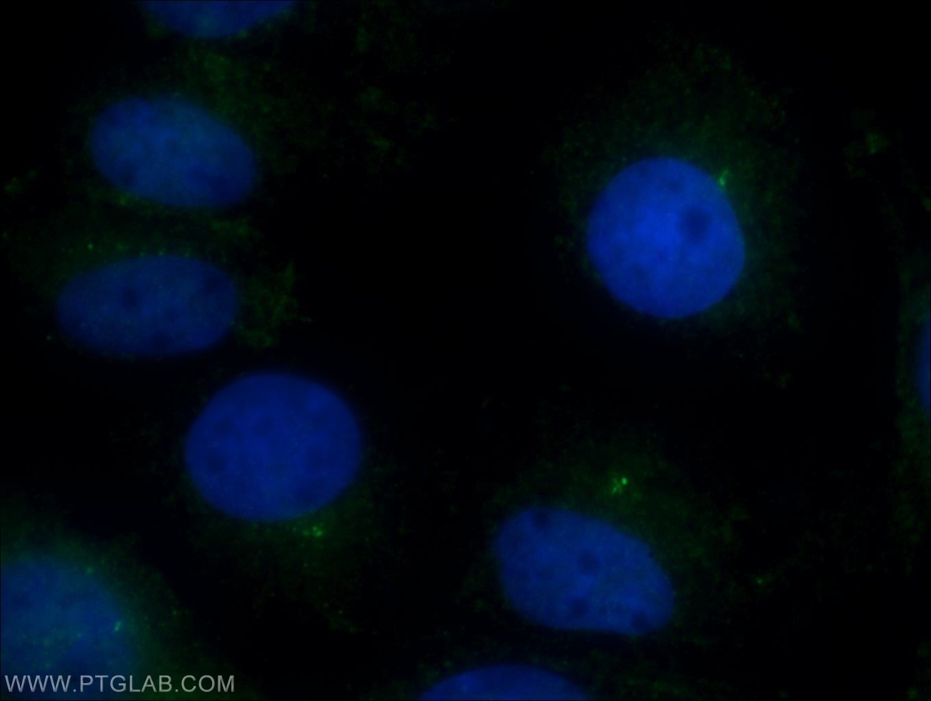 Immunofluorescence (IF) / fluorescent staining of MDCK cells using CEP97 Polyclonal antibody (22050-1-AP)