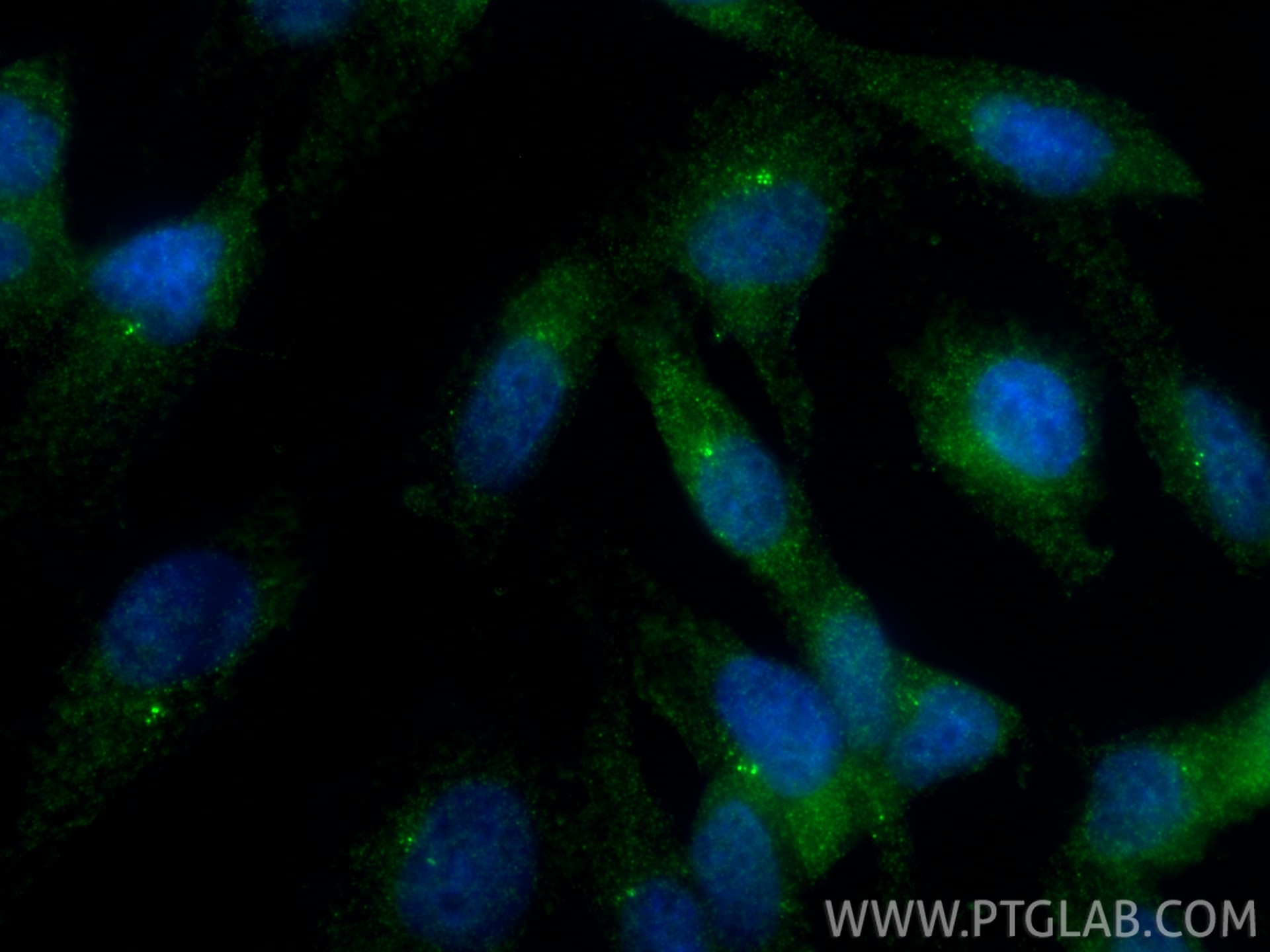 Immunofluorescence (IF) / fluorescent staining of MDCK cells using CEP97 Polyclonal antibody (22050-1-AP)