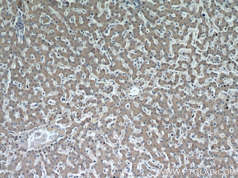 Immunohistochemistry (IHC) staining of human liver tissue using CEP97 Polyclonal antibody (22050-1-AP)