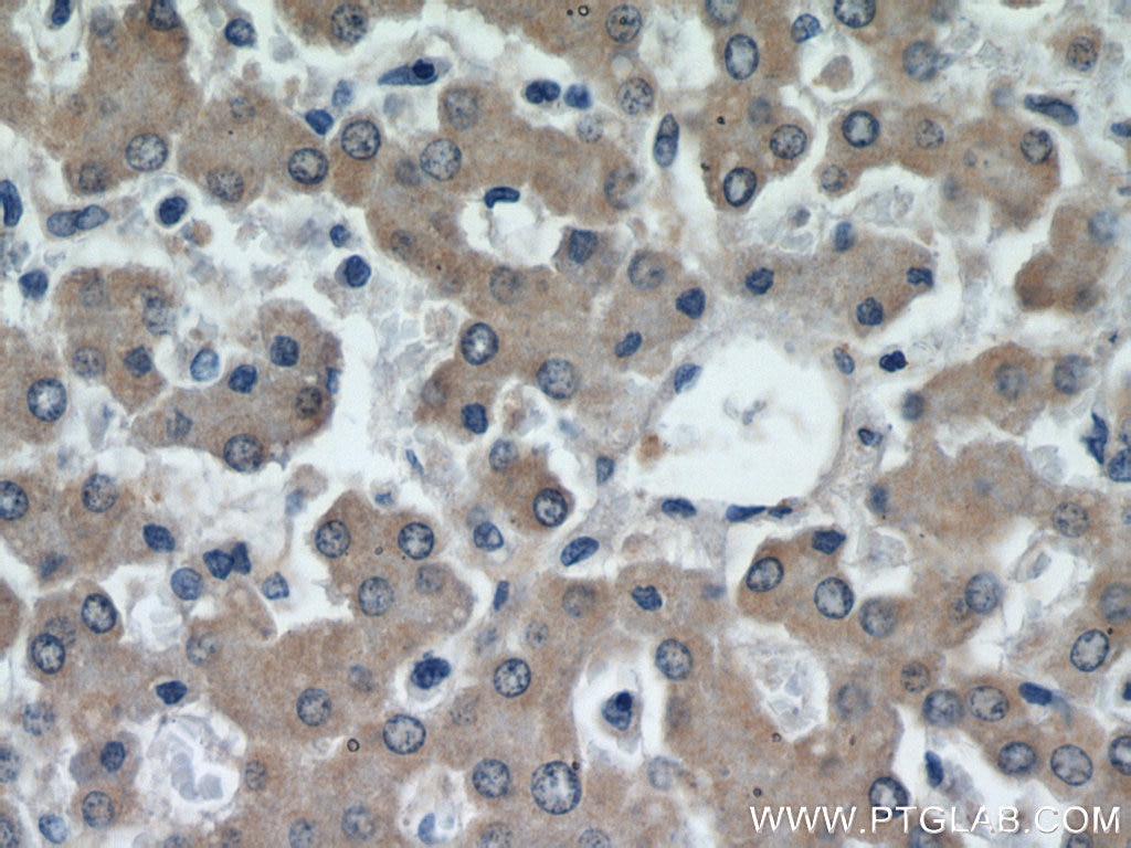 Immunohistochemistry (IHC) staining of human liver tissue using CEP97 Polyclonal antibody (22050-1-AP)