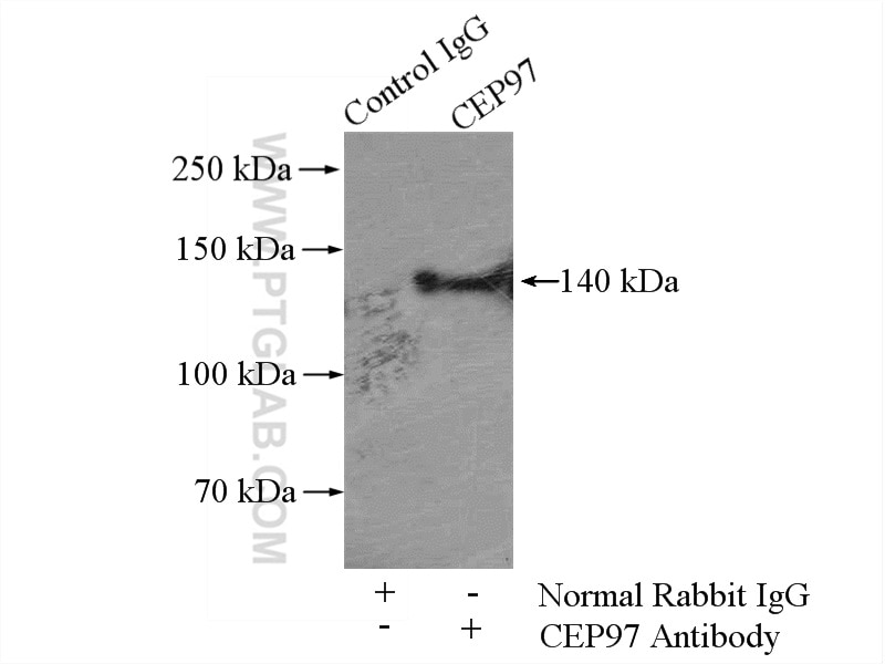 Immunoprecipitation (IP) experiment of HeLa cells using CEP97 Polyclonal antibody (22050-1-AP)