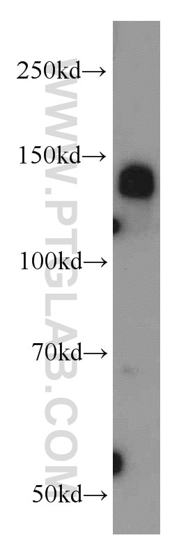 Western Blot (WB) analysis of HL-60 cells using CEP97 Polyclonal antibody (22050-1-AP)
