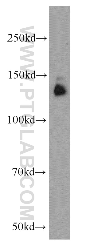 Western Blot (WB) analysis of HeLa cells using CEP97 Polyclonal antibody (22050-1-AP)