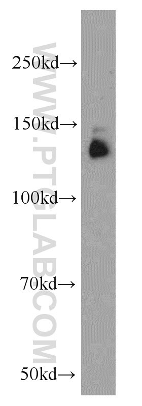 WB analysis of HeLa using 22050-1-AP