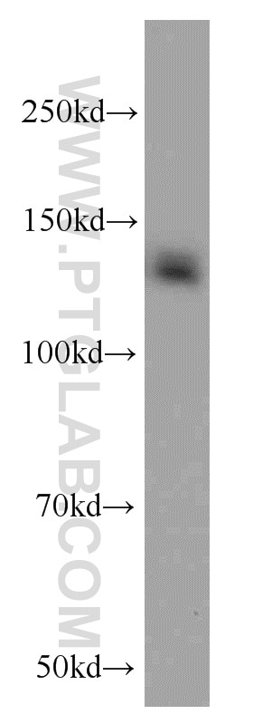 Western Blot (WB) analysis of HEK-293 cells using CEP97 Polyclonal antibody (22050-1-AP)