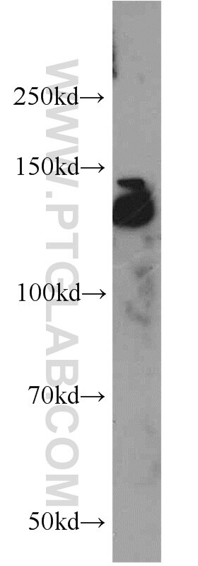 Western Blot (WB) analysis of PC-3 cells using CEP97 Polyclonal antibody (22050-1-AP)