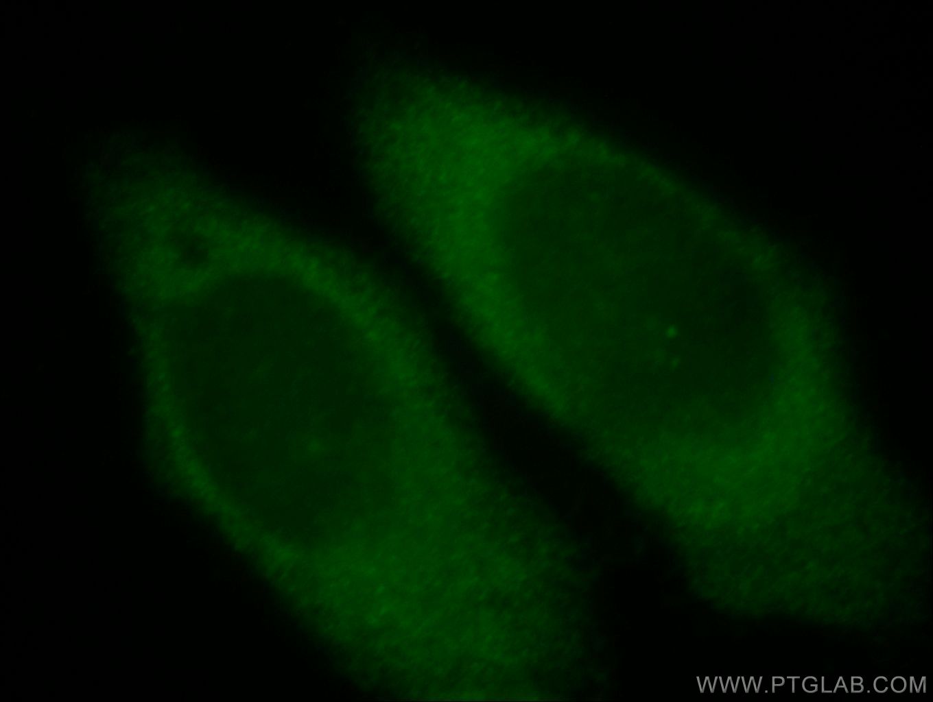 Immunofluorescence (IF) / fluorescent staining of HepG2 cells using CEPT1 Polyclonal antibody (20496-1-AP)