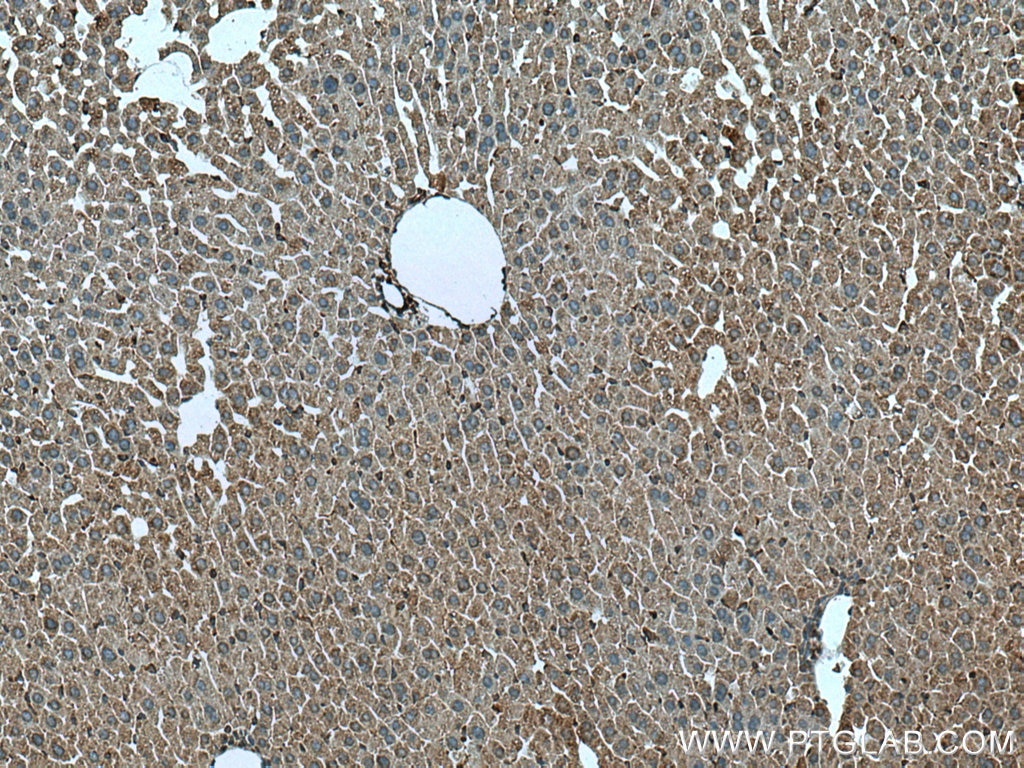 Immunohistochemistry (IHC) staining of mouse liver tissue using CEPT1 Polyclonal antibody (20496-1-AP)