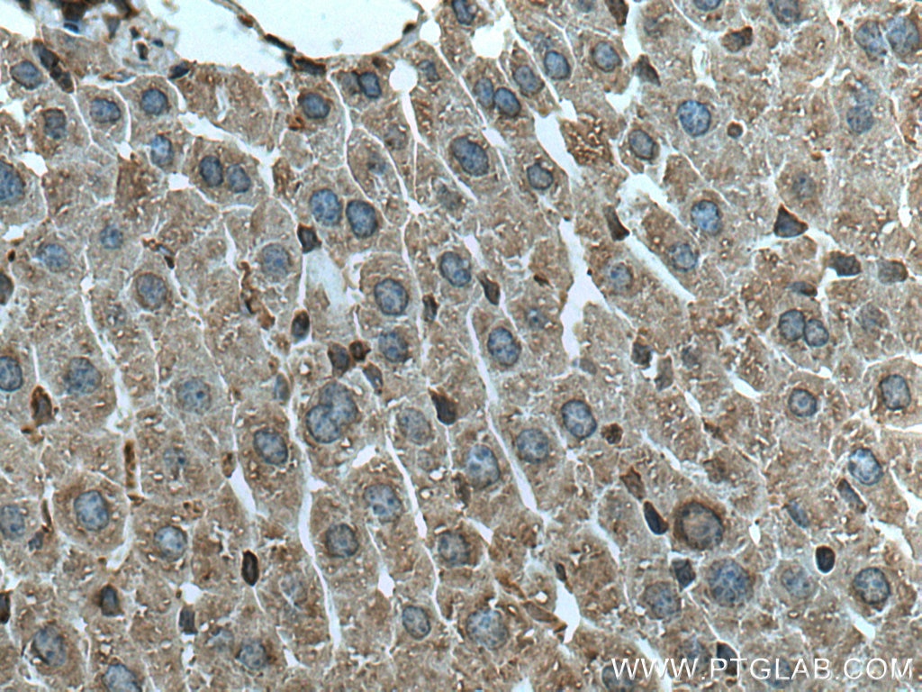 Immunohistochemistry (IHC) staining of mouse liver tissue using CEPT1 Polyclonal antibody (20496-1-AP)