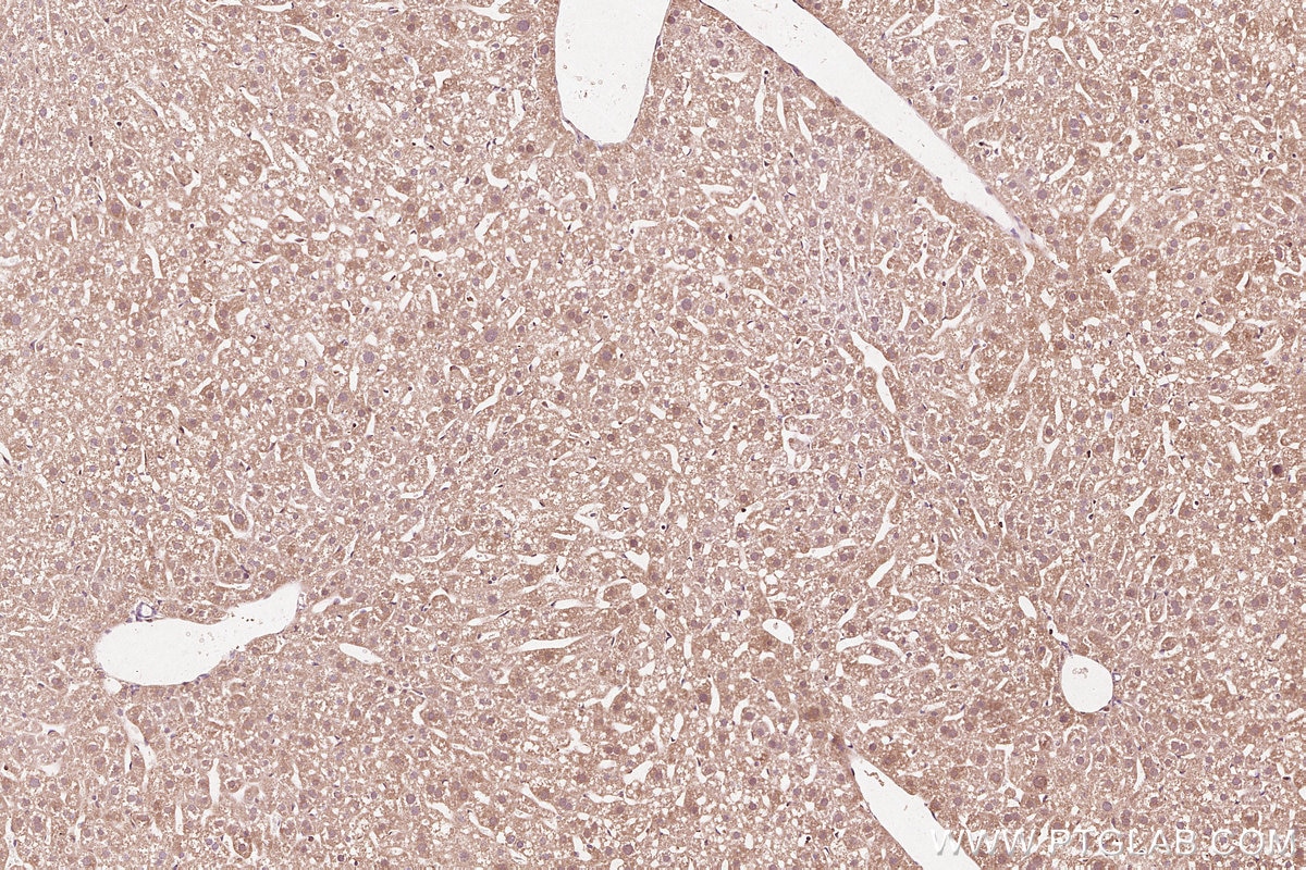 Immunohistochemistry (IHC) staining of mouse liver tissue using CEPT1 Polyclonal antibody (20496-1-AP)