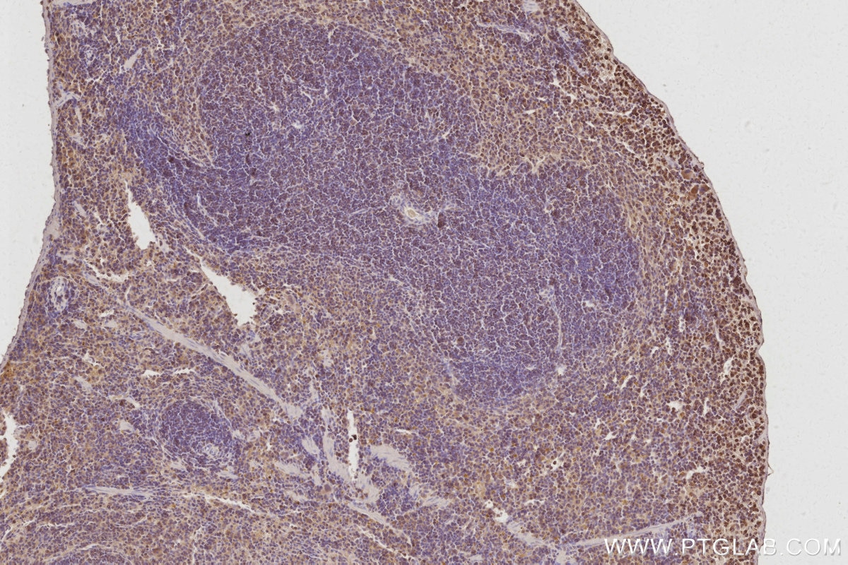 Immunohistochemistry (IHC) staining of mouse spleen tissue using CEPT1 Polyclonal antibody (20496-1-AP)