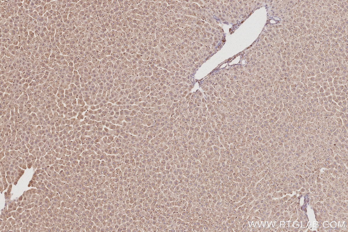 Immunohistochemistry (IHC) staining of rat liver tissue using CEPT1 Polyclonal antibody (20496-1-AP)