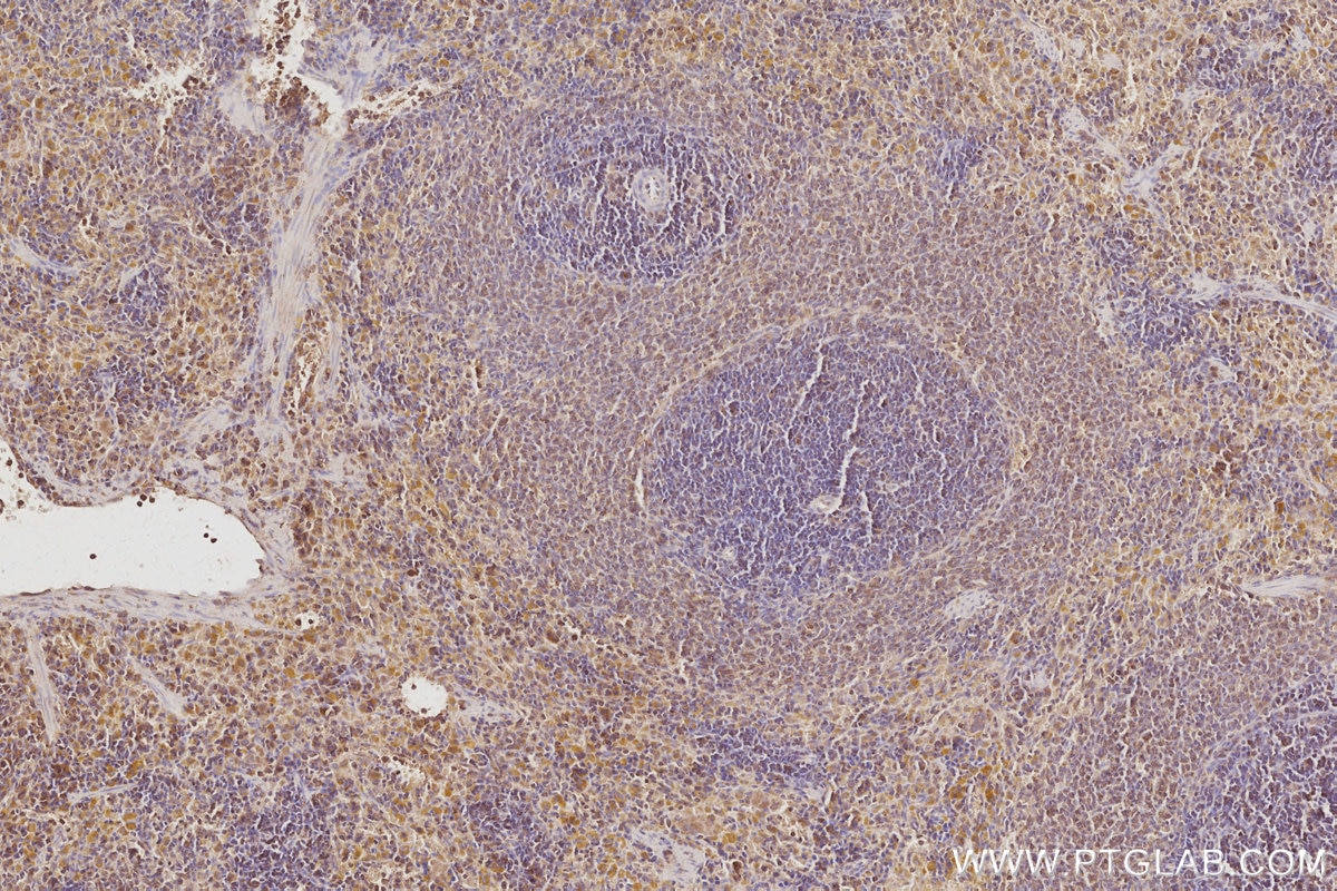 Immunohistochemistry (IHC) staining of rat spleen tissue using CEPT1 Polyclonal antibody (20496-1-AP)