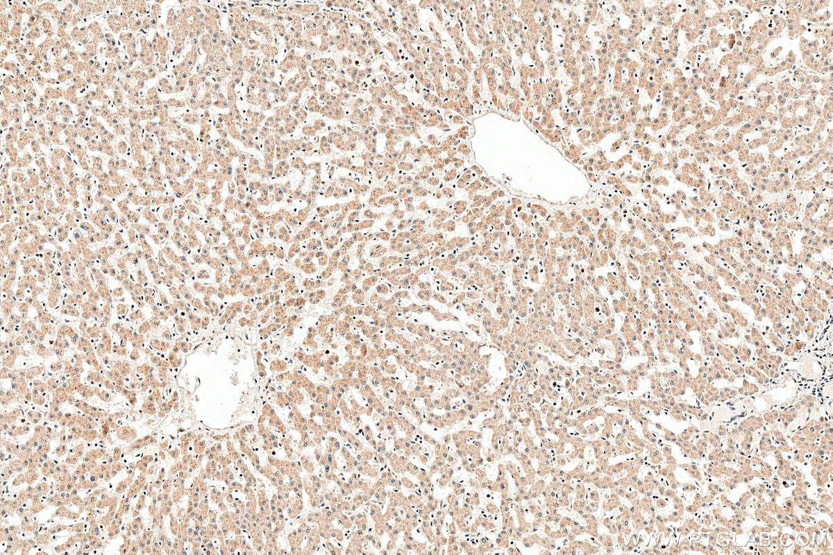 Immunohistochemistry (IHC) staining of human liver tissue using CEPT1 Polyclonal antibody (20496-1-AP)