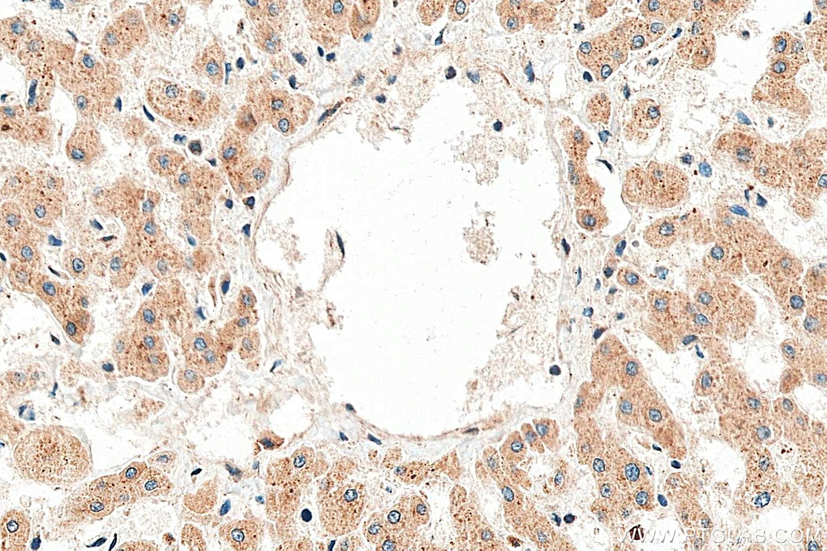 Immunohistochemistry (IHC) staining of human liver tissue using CEPT1 Polyclonal antibody (20496-1-AP)