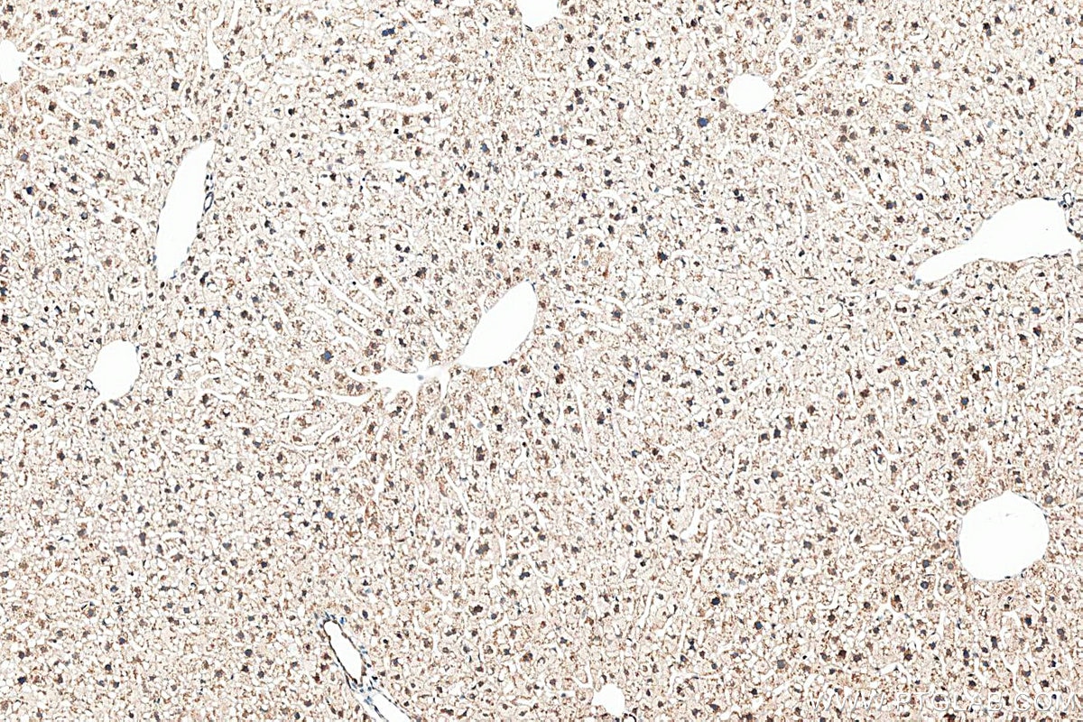 Immunohistochemistry (IHC) staining of mouse liver tissue using CEPT1 Polyclonal antibody (20496-1-AP)