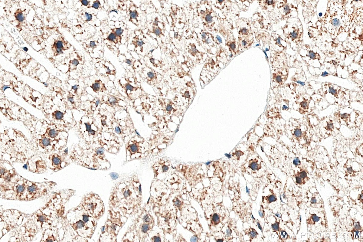 Immunohistochemistry (IHC) staining of mouse liver tissue using CEPT1 Polyclonal antibody (20496-1-AP)